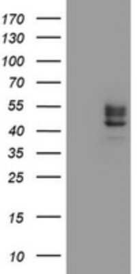 Western Blot: Carbohydrate Sulfotransferase 6/CHST6 Antibody (OTI1D1) - Azide and BSA Free [NBP2-71195] - Analysis of HEK293T cells were transfected with the pCMV6-ENTRY control (Left lane) or pCMV6-ENTRY Carbohydrate Sulfotransferase 6.