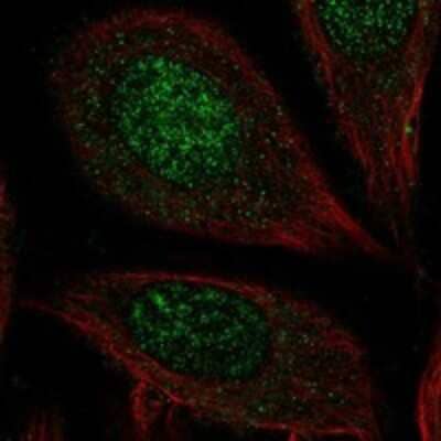 Immunocytochemistry/ Immunofluorescence Carbohydrate Sulfotransferase 7/CHST7 Antibody