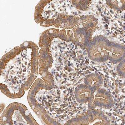 Immunohistochemistry: Carbohydrate Sulfotransferase 7/CHST7 Antibody [NBP1-91248] - Staining of human duodenum shows moderate cytoplasmic and membranous positivity in glandular cells.