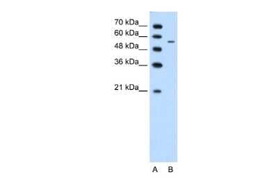 Western Blot: Carbohydrate Sulfotransferase 7/CHST7 Antibody [NBP2-87122] - WB Suggested Anti-CHST7 Antibody Titration: 1.25ug/ml. Positive Control: Jurkat cell lysate