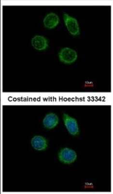 Immunocytochemistry/Immunofluorescence: Carbohydrate sulfotransferase 2 Antibody [NBP2-15696] - Immunofluorescence analysis of methanol-fixed MCF-7, using antibody at 1:500 dilution.