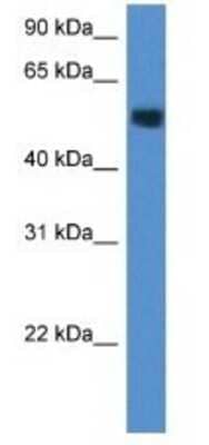 Western Blot: Carbohydrate sulfotransferase 2 Antibody [NBP1-79191] - Mouse Brain Lysate 1ug/ml Gel Concentration 12%