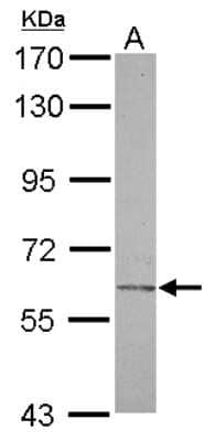 Western Blot: Carbohydrate sulfotransferase 2 Antibody [NBP2-15696] - Sample (30 ug of whole cell lysate) A: U87-MG 7. 5% SDS PAGE gel, diluted at 1:1000.