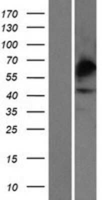 Western Blot: Carbohydrate-sulfotransferase-4 Overexpression Lysate (Adult Normal) [NBP2-10441] Left-Empty vector transfected control cell lysate (HEK293 cell lysate); Right -Over-expression Lysate for Carbohydrate-sulfotransferase-4.