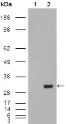 Western Blot: Carbonic Anhydrase I/CA1 Antibody (9D6D7) [NBP1-47415] - Analysis using CA1 mouse mAb against HEK293T cells transfected with the pCMV6-ENTRY control (1) and pCMV6-ENTRY CA1 cDNA (2).