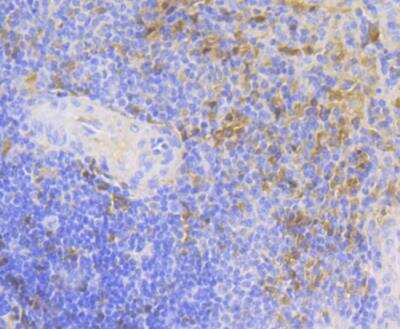 Immunohistochemistry: Carbonic Anhydrase I/CA1 Antibody (JG38-71) [NBP2-76980] - Immunohistochemical analysis of paraffin-embedded human spleen tissue using anti-Carbonic Anhydrase I antibody. Counter stained with hematoxylin.