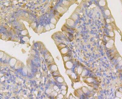 Immunohistochemistry: Carbonic Anhydrase I/CA1 Antibody (JG38-71) [NBP2-76980] - Immunohistochemical analysis of paraffin-embedded human small intestine tissue using anti-Carbonic Anhydrase I antibody. Counter stained with hematoxylin.