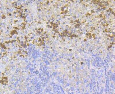 Immunohistochemistry: Carbonic Anhydrase I/CA1 Antibody (JG38-71) [NBP2-76980] - Immunohistochemical analysis of paraffin-embedded mouse spleen tissue using anti-Carbonic Anhydrase I antibody. Counter stained with hematoxylin.
