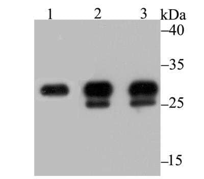 Western Blot: Carbonic Anhydrase I/CA1 Antibody (JG38-71) [NBP2-76980] - Western blot analysis of Carbonic Anhydrase I on different lysates using anti-Carbonic Anhydrase I antibody at 1/1,000 dilution.Positive control:Lane 1: Human colon Lane 2: Mouse spleenLane 3: Mouse colon