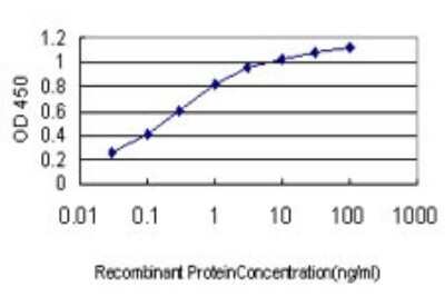Sandwich ELISA: Carbonic Anhydrase I/CA1 Antibody (M2) [H00000759-M02] - Detection limit for recombinant GST tagged CA1 is approximately 0.03ng/ml as a capture antibody.