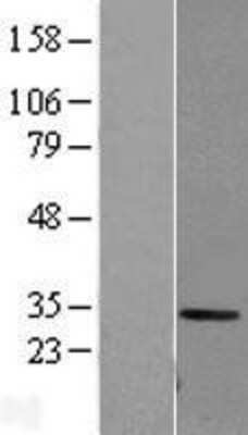 Western Blot: Carbonic Anhydrase I Overexpression Lysate (Adult Normal) [NBL1-08609] Left-Empty vector transfected control cell lysate (HEK293 cell lysate); Right -Over-expression Lysate for Carbonic Anhydrase I.