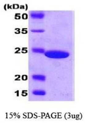 SDS-Page: Carbonic Anhydrase I Protein [NBC1-18527] - Carbonic anhydrase, 27kDa (240aa), confirmed by MALDI-TOF with a purity of 95% by SDS - PAGE