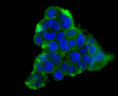 Immunocytochemistry/Immunofluorescence: Carbonic Anhydrase II/CA2 Antibody (11A1) [NBP2-76974] - ICC staining Carbonic anhydrase 2 in 293T cells (green). Formalin fixed cells were permeabilized with 0.1% Triton X-100 in TBS for 10 minutes at room temperature and blocked with 1% Blocker BSA for 15 minutes at room temperature. Cells were probed with Carbonic anhydrase 2 monoclonal antibody at a dilution of 1:100 for at least 1 hour at room temperature, washed with PBS. Alexa Fluorc 488 Goat anti-Mouse IgG was used as the secondary antibody at 1/100 dilution. The nuclear counter stain is DAPI (blue).