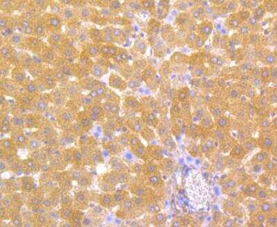 Immunohistochemistry: Carbonic Anhydrase II/CA2 Antibody (11A1) [NBP2-76974] - Immunohistochemical analysis of paraffin-embedded rat liver tissue using anti-Carbonic anhydrase 2 antibody. The section was pre-treated using heat mediated antigen retrieval with Tris-EDTA buffer (pH 8.0-8.4) for 20 minutes.The tissues were blocked in 5% BSA for 30 minutes at room temperature, washed with ddH2O and PBS, and then probed with the antibody at 1/100 dilution, for 30 minutes at room temperature and detected using an HRP conjugated compact polymer system. DAB was used as the chrogen. Counter stained with hematoxylin and mounted with DPX.
