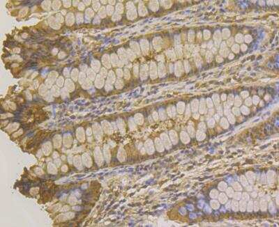 Immunohistochemistry: Carbonic Anhydrase II/CA2 Antibody (11A1) [NBP2-76974] - Immunohistochemical analysis of paraffin-embedded human colon tissue using anti-Carbonic anhydrase 2 antibody. The section was pre-treated using heat mediated antigen retrieval with Tris-EDTA buffer (pH 8.0-8.4) for 20 minutes.The tissues were blocked in 5% BSA for 30 minutes at room temperature, washed with ddH2O and PBS, and then probed with the antibody at 1/100 dilution, for 30 minutes at room temperature and detected using an HRP conjugated compact polymer system. DAB was used as the chrogen. Counter stained with hematoxylin and mounted with DPX.