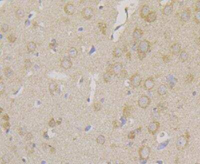 Immunohistochemistry: Carbonic Anhydrase II/CA2 Antibody (11A1) [NBP2-76974] - Immunohistochemical analysis of paraffin-embedded mouse brain tissue using anti-Carbonic anhydrase 2 antibody. The section was pre-treated using heat mediated antigen retrieval with Tris-EDTA buffer (pH 8.0-8.4) for 20 minutes.The tissues were blocked in 5% BSA for 30 minutes at room temperature, washed with ddH2O and PBS, and then probed with the antibody at 1/100 dilution, for 30 minutes at room temperature and detected using an HRP conjugated compact polymer system. DAB was used as the chrogen. Counter stained with hematoxylin and mounted with DPX.
