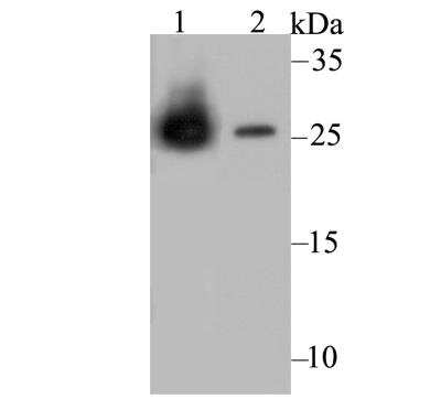 Western Blot: Carbonic Anhydrase II/CA2 Antibody (11A1) [NBP2-76974] - Western blot analysis of Carbonic anhydrase 2 on different cell lysates. Proteins were transferred to a PVDF membrane and blocked with 5% BSA in PBS for 1 hour at room temperature. The primary antibody was used at a 1:1,000 dilution in 5% BSA at room temperature for 2 hours. Goat Anti-Mouse IgG - HRP Secondary Antibody at 1:5,000 dilution was used for 1 hour at room temperature.Positive control: Lane 1: THP-1 cell lysate, untreated Lane 2: HL-60 cell lysate, untreated