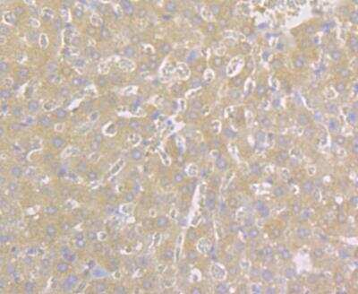 Immunohistochemistry: Carbonic Anhydrase II/CA2 Antibody (11A2) [NBP2-76824] - Immunohistochemical analysis of paraffin-embedded rat liver tissue using anti-Carbonic anhydrase 2 antibody. The section was pre-treated using heat mediated antigen retrieval with Tris-EDTA buffer (pH 8.0-8.4) for 20 minutes.The tissues were blocked in 5% BSA for 30 minutes at room temperature, washed with ddH2O and PBS, and then probed with the antibody at 1/100 dilution, for 30 minutes at room temperature and detected using an HRP conjugated compact polymer system. DAB was used as the chrogen. Counter stained with hematoxylin and mounted with DPX.