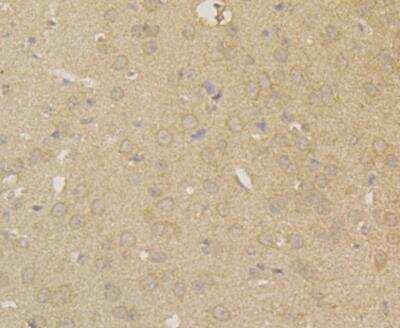 Immunohistochemistry: Carbonic Anhydrase II/CA2 Antibody (11A2) [NBP2-76824] - Immunohistochemical analysis of paraffin-embedded mouse brain tissue using anti-Carbonic anhydrase 2 antibody. The section was pre-treated using heat mediated antigen retrieval with Tris-EDTA buffer (pH 8.0-8.4) for 20 minutes.The tissues were blocked in 5% BSA for 30 minutes at room temperature, washed with ddH2O and PBS, and then probed with the antibody at 1/100 dilution, for 30 minutes at room temperature and detected using an HRP conjugated compact polymer system. DAB was used as the chrogen. Counter stained with hematoxylin and mounted with DPX.