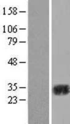 Western Blot: Carbonic Anhydrase II Overexpression Lysate (Adult Normal) [NBL1-08615] Left-Empty vector transfected control cell lysate (HEK293 cell lysate); Right -Over-expression Lysate for Carbonic Anhydrase II.