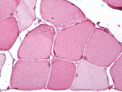 Immunohistochemistry-Paraffin: Carbonic Anhydrase III/CA3 Antibody [NBP2-11503] - Analysis of anti-CA3 / Carbonic Anhydrase III antibody with human skeletal muscle at concentration 5 ug/ml.