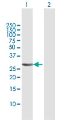 Western Blot: Carbonic Anhydrase III/CA3 Antibody [H00000761-B01P] - Analysis of CA3 expression in transfected 293T cell line by CA3 polyclonal antibody.  Lane 1: CA3 transfected lysate(29.60 KDa). Lane 2: Non-transfected lysate.