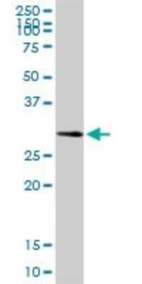 Western Blot: Carbonic Anhydrase III/CA3 Antibody [H00000761-D01P] - Analysis of CA3 expression in human liver.