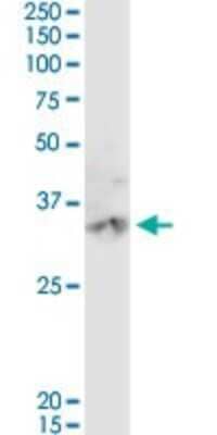 Western Blot: Carbonic Anhydrase III/CA3 Antibody [H00000761-D01P] - Analysis of CA3 expression in mouse lung.