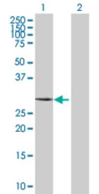 Western Blot: Carbonic Anhydrase III/CA3 Antibody [H00000761-D01P] - Analysis of CA3 expression in transfected 293T cell line by CA3 polyclonal antibody.Lane 1: CA3 transfected lysate(29.60 KDa).Lane 2: Non-transfected lysate.