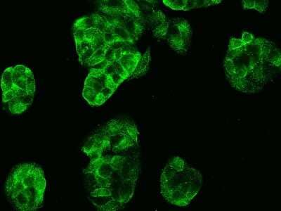 Immunocytochemistry/Immunofluorescence: Carbonic Anhydrase VB/CA5B Antibody [NBP2-99971] - Immunofluorescence staining of Carbonic Anhydrase VB/CA5B in MCF7 cells. Cells were fixed with 4% PFA, permeabilzed with 0.1% Triton X-100 in PBS, blocked with 10% serum, and incubated with rabbit anti-Human Carbonic Anhydrase VB/CA5B polyclonal antibody (dilution ratio 1:1000) at 4C overnight. Then cells were stained with the Alexa Fluor(R)488-conjugated Goat Anti-rabbit IgG secondary antibody (green). Positive staining was localized to Cytoplasm.