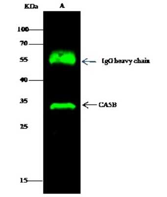 Immunoprecipitation: Carbonic Anhydrase VB/CA5B Antibody [NBP2-99972] - Carbonic Anhydrase VB/CA5B was immunoprecipitated using: Lane A: 0.5 mg MCF-7 Whole Cell Lysate. 2 ul anti-Carbonic Anhydrase VB/CA5B rabbit polyclonal antibody and 15 ul of 50 % Protein G agarose. Primary antibody: Anti-Carbonic Anhydrase VB/CA5B rabbit polyclonal antibody, at 1:200 dilution. Secondary antibody: Dylight 800-labeled antibody to rabbit IgG (H+L), at 1:5000 dilution. Developed using the Odyssey technique. Performed under reducing conditions. Predicted band size: 35 kDa. Observed band size: 35 kDa
