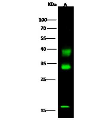 Western Blot: Carbonic Anhydrase VB/CA5B Antibody [NBP2-99972] - Anti-Carbonic Anhydrase VB/CA5B rabbit polyclonal antibody at 1:500 dilution. Lane A: Mouse liver tissue Lysate. Lysates/proteins at 30 ug per lane. Secondary Goat Anti-Rabbit IgG H&L (Dylight 800) at 1/10000 dilution. Developed using the Odyssey technique. Performed under reducing conditions. Predicted band size: 36 kDa. Observed band size: 38 kDa (We are unsure as to the identity of these extra bands).