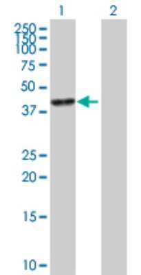 Western Blot: Carbonic Anhydrase VI Antibody [H00000765-B01P] - Analysis of CA6 expression in transfected 293T cell line by CA6 polyclonal antibody.  Lane 1: CA6 transfected lysate(33.88 KDa). Lane 2: Non-transfected lysate.