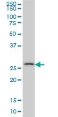Western Blot: Carbonic Anhydrase VII/CA7 Antibody (3B7) [H00000766-M06] - Analysis of CA7 expression in Hela S3 NE (Cat # L013V3).