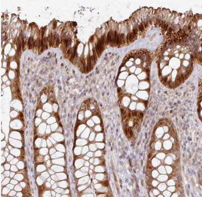 Immunohistochemistry-Paraffin Carbonic Anhydrase VII/CA7 Antibody - BSA Free