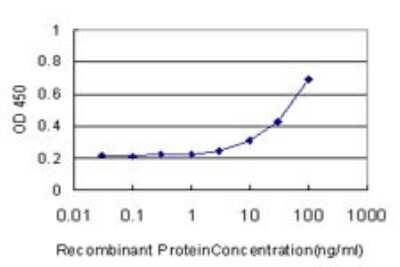 Sandwich ELISA: Carbonic Anhydrase VIII/CA8 Antibody (1F7) [H00000767-M01] - Detection limit for recombinant GST tagged CA8 is approximately 3ng/ml as a capture antibody.