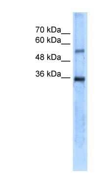 Western Blot: Carbonic Anhydrase VIII/CA8 Antibody [NBP1-54947] - Titration: 5.0ug/ml Positive Control: SK-MEL-2 cell lysate.