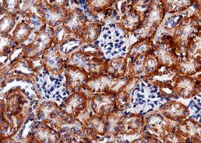 Immunohistochemistry-Paraffin: Carbonic Anhydrase XII/CA12 Antibody (012) [NBP2-90352] - Staining of mouse CA12 in mouse kidney with rabbit monoclonal antibody (1:200).