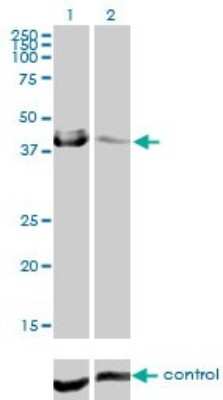Western Blot: Carbonic Anhydrase XII/CA12 Antibody (1D4) [H00000771-M01] - Analysis of CA12 over-expressed 293 cell line, cotransfected with CA12 Validated Chimera RNAi ( Cat # H00000771-R01V ) (Lane 2) or non-transfected control (Lane 1). Blot probed with CA12 monoclonal antibody (M01), clone 1D4 (Cat # H00000771-M01 ). GAPDH ( 36.1 kDa ) used as specificity and loading control.