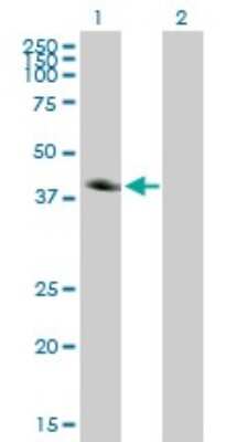 Western Blot: Carbonic Anhydrase XII/CA12 Antibody (1D4) [H00000771-M01] - Analysis of CA12 expression in transfected 293T cell line by CA12 monoclonal antibody (M01), clone 1D4.Lane 1: CA12 transfected lysate(39.5 KDa).Lane 2: Non-transfected lysate.