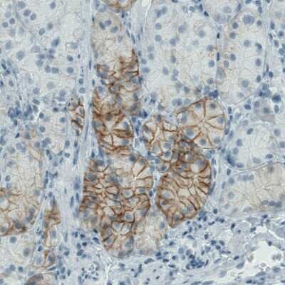 Immunohistochemistry-Paraffin: Carbonic Anhydrase XII/CA12 Antibody (CL0278) [NBP2-52901] - Staining of human stomach shows moderate membranous immunoreactivity in glandular cells.