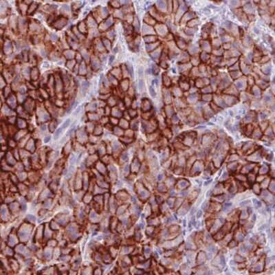 Immunohistochemistry-Paraffin: Carbonic Anhydrase XII/CA12 Antibody (CL0280) [NBP2-52902] - Staining of human pancreas shows strong membranous and moderate cytopalsmic positivity in the exocrine cells.