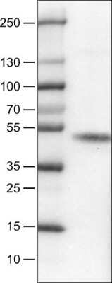 Western Blot: Carbonic Anhydrase XII/CA12 Antibody (CL0280) [NBP2-52902] - Lane 1: Marker [kDa], Lane 2: Human RT-4 cell line