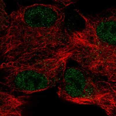 Immunocytochemistry/Immunofluorescence: Carbonic Anhydrase XII/CA12 Antibody [NBP2-57791] - Staining of human cell line A549 shows localization to nucleoplasm & vesicles.