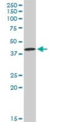 Western Blot: Carbonic Anhydrase XII/CA12 Antibody [H00000771-D01P] - Analysis of CA12 expression in MCF-7.