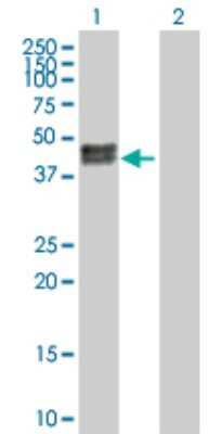 Western Blot: Carbonic Anhydrase XII/CA12 Antibody [H00000771-D01P] - Analysis of CA12 expression in transfected 293T cell line by CA12 polyclonal antibody.Lane 1: CA12 transfected lysate(39.50 KDa).Lane 2: Non-transfected lysate.