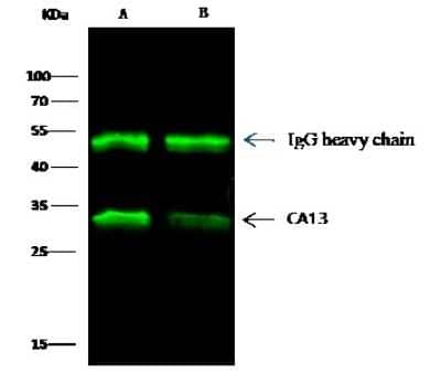 Immunoprecipitation: Carbonic Anhydrase XIII/CA13 Antibody [NBP2-99317] - Carbonic Anhydrase XIII/CA13 was immunoprecipitated using: Lane A: 0.5 mg HepG2 Whole Cell Lysate. Lane B: 0.5 mg K562 Whole Cell Lysate. 2 ul anti-Carbonic Anhydrase XIII/CA13 rabbit polyclonal antibody and 15 ul of 50 % Protein G agarose. Primary antibody: Anti-Carbonic Anhydrase XIII/CA13 rabbit polyclonal antibody, at 1:500 dilution. Secondary antibody: Dylight 800-labeled antibody to rabbit IgG (H+L), at 1:5000 dilution. Developed using the Odyssey technique. Performed under reducing conditions. Predicted band size: 29 kDa. Observed band size: 29 kDa
