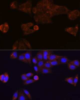 Immunocytochemistry/Immunofluorescence: Carboxylesterase 1/CES1 Antibody (7C9R6) [NBP3-15388] - Immunofluorescence analysis of HeLa cells using Carboxylesterase 1/CES1 Rabbit mAb (NBP3-15388) at dilution of 1:100 (40x lens). Blue: DAPI for nuclear staining.