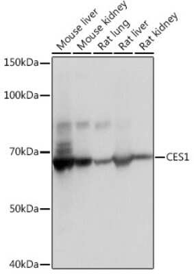 Western Blot: Carboxylesterase 1/CES1 Antibody (7C9R6) [NBP3-15388] - Western blot analysis of extracts of various cell lines, using Carboxylesterase 1/CES1 Rabbit mAb (NBP3-15388) at 1:1000 dilution. Secondary antibody: HRP Goat Anti-Rabbit IgG (H+L) at 1:10000 dilution. Lysates/proteins: 25ug per lane. Blocking buffer: 3% nonfat dry milk in TBST. Detection: ECL Basic Kit. Exposure time: 1s.