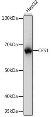 Western Blot: Carboxylesterase 1/CES1 Antibody (7C9R6) [NBP3-15388] - Western blot analysis of extracts of HepG2 cells, using Carboxylesterase 1/CES1 Rabbit mAb (NBP3-15388) at 1:1000 dilution. Secondary antibody: HRP Goat Anti-Rabbit IgG (H+L) at 1:10000 dilution. Lysates/proteins: 25ug per lane. Blocking buffer: 3% nonfat dry milk in TBST. Detection: ECL Basic Kit. Exposure time: 1s.